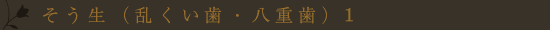 叢生(乱くい歯・八重歯)1