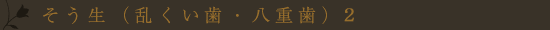 叢生(乱くい歯・八重歯)2
