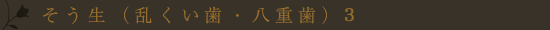 叢生(乱くい歯・八重歯)3