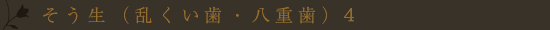 叢生(乱くい歯・八重歯)4