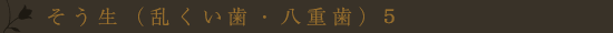 叢生(乱くい歯・八重歯)5