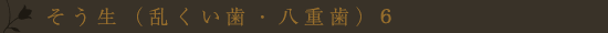 叢生(乱くい歯・八重歯)6