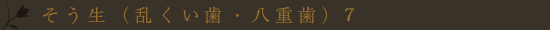 叢生(乱くい歯・八重歯)7