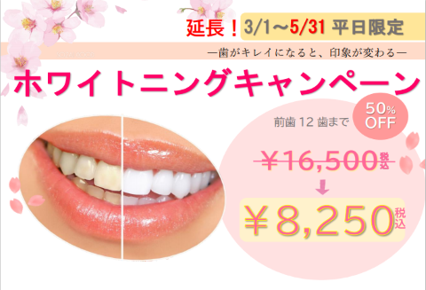 ホワイトニングキャンペーン